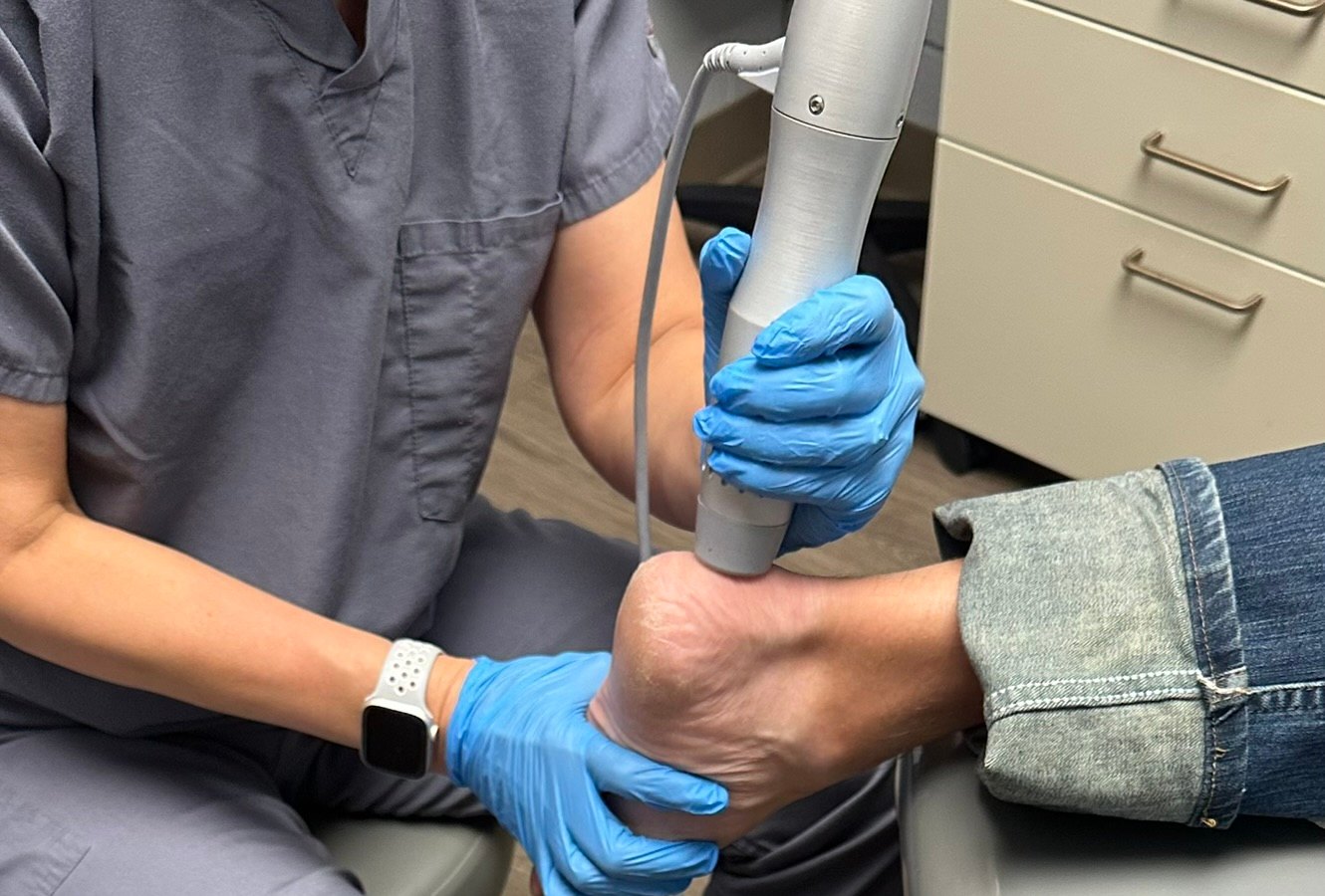 Dr. Korves using the ESWT handpiece on an anonymous patient’s heel during treatment